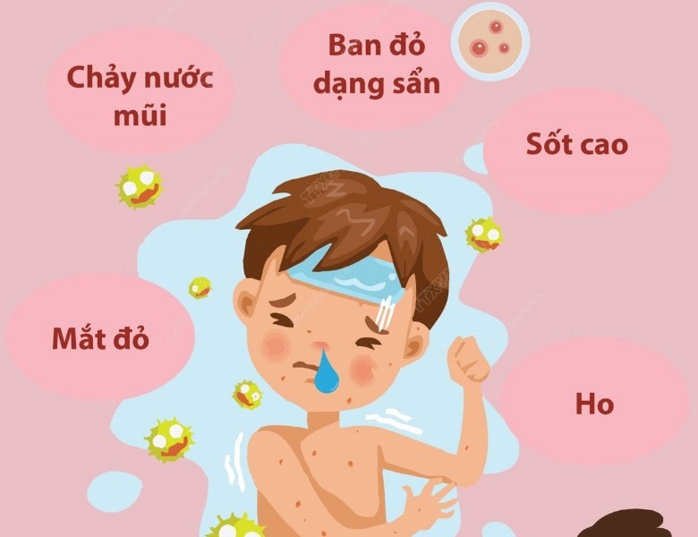 Nhiều quốc gia châu Mỹ sắp mất danh hiệu 'loại trừ bệnh sởi'